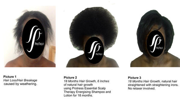 proven results - thin afro hair becoming thick after using ProTress