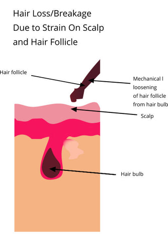 locs can cause mechanical loosening of hair follicle from hair bulb resulting in hair loss