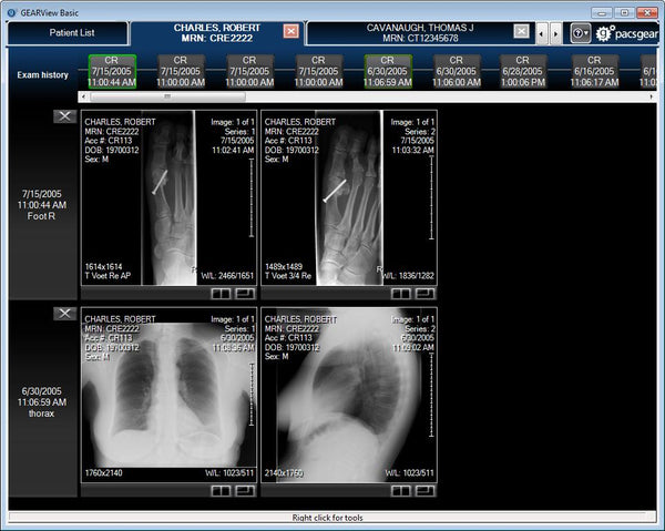 Gearview example