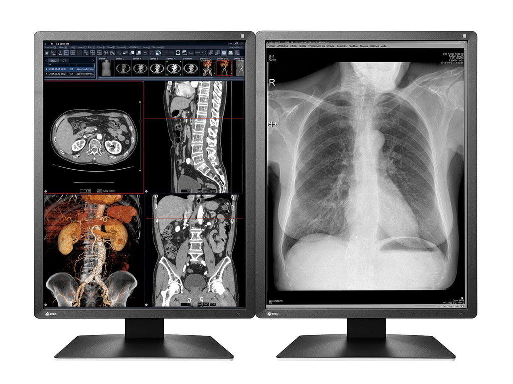 Eizo RadiForce MX216 2MP Color LED Medical Display Monitor (MX216-BK)