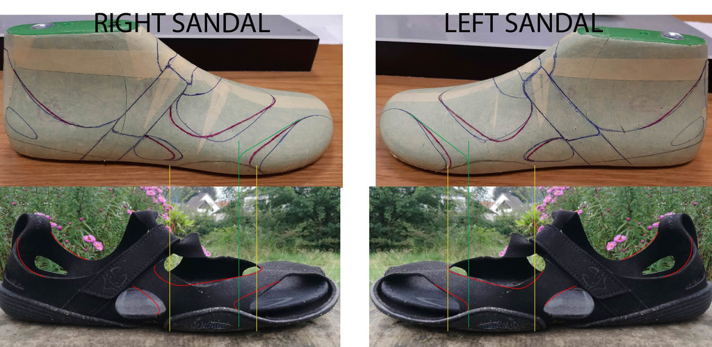 The image illustrates adjustments to the pattern using markings on two opposing black Wildling Shoes sandals. These are indicated again with similar markings drawn on a foot model above the sandals.