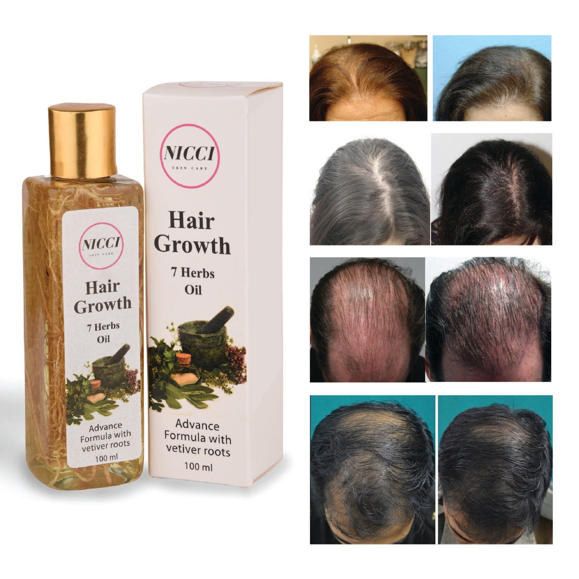 Organic Hair Oil| Best Product For Hair Growth, Dandruff Control – Nicci  Skin Care