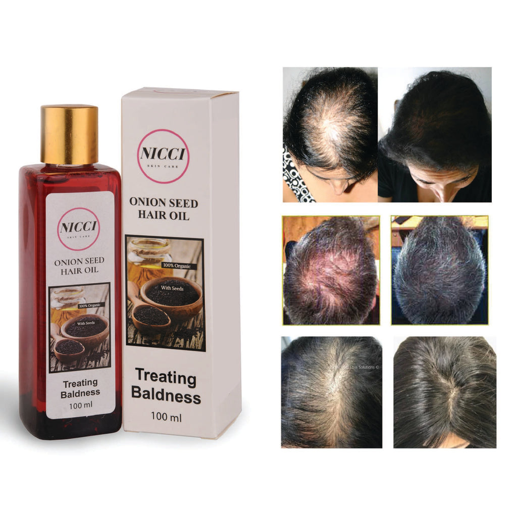 Onion Seed Hair Oil Best Oil Essential For Hair Loss Regrowth Nicci Skin Care