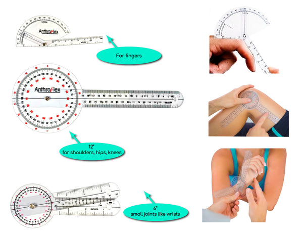 what is a gooniometer