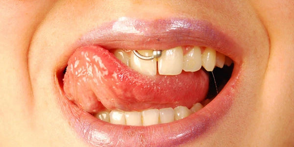 The Smiley Piercing Everything You Need To Know Freshtrends Freshtrends