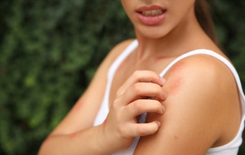 Benefits Of Homemade Mosquito Repellent
