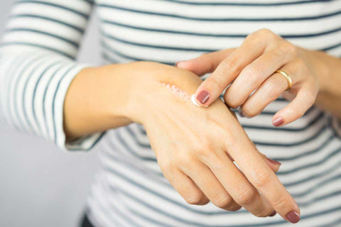 Coconut Oil For Old Scars