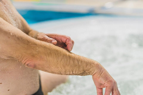 Best Essential Oils for Swimmer's Itch