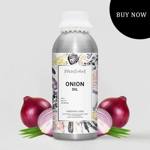 Onion Essential Oil For Alopecia Areata
