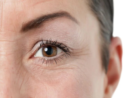Castor Oil For Under-Eye Wrinkles