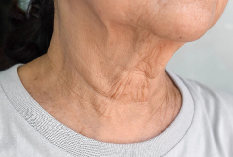 Castor Oil For Wrinkles On The Chin And Neckline