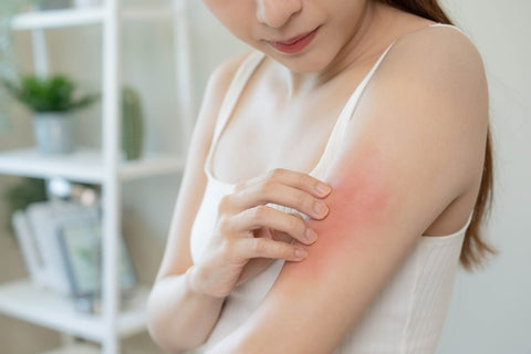 Different Types of Dermatitis