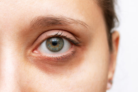 castor oil for dark circles