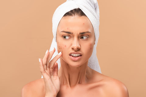 Glycolic acid benefits for acne