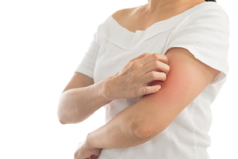 Essential Oils for Psoriatic Arthritis