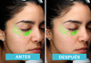 Antes y después detox facial