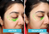 Antes y después detox facial