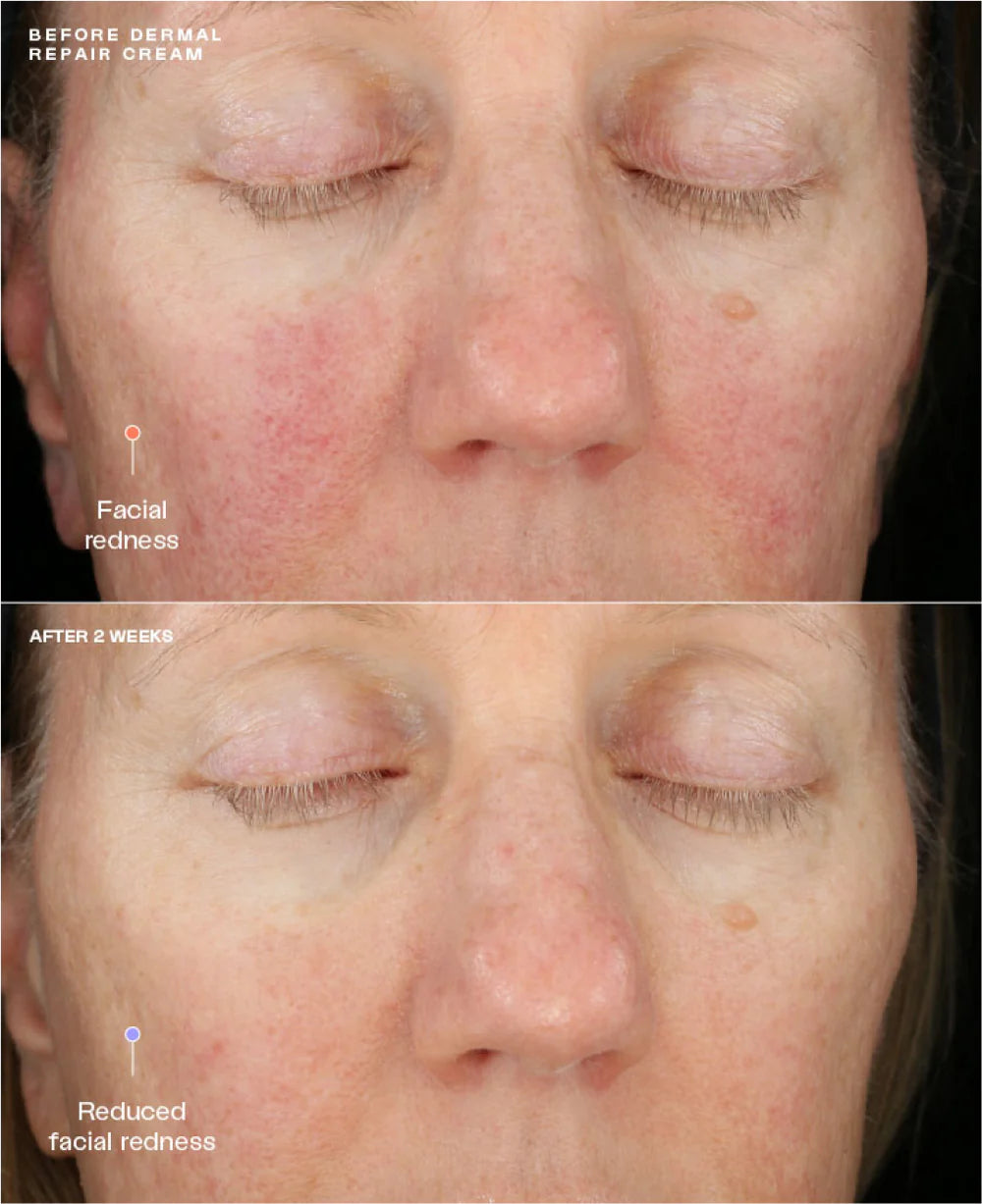 Sente dermal repair cream store