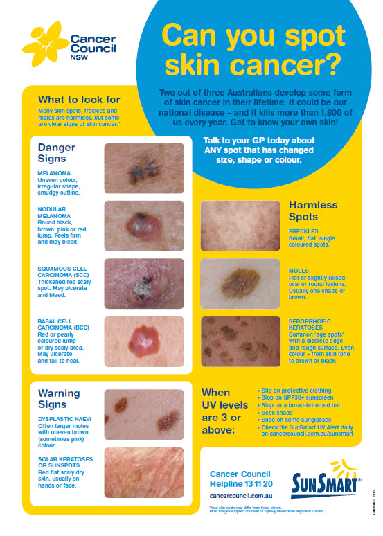 Cancer Council Melanoma Chart