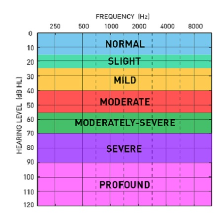 Audiogram Level / Frequency