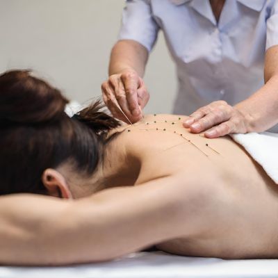 A woman in an acupuncture session.