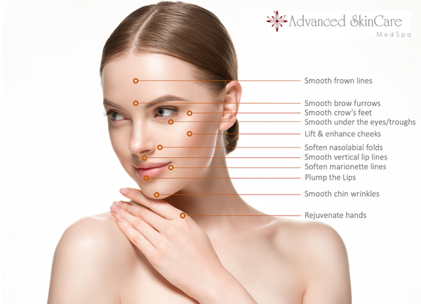 Advanced Skin Care NYC provides fillers; this figure shows how fillers can smooth frown lines, smooth crow's feet, smooth under the eye troughs, lift and enhance cheeks, soften nasolabial folds, smooth vertical lip lines, soften marionette lines, plump the lips, smooth chin wrinkles and Rejuvenate hands.