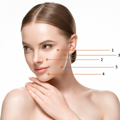 Advanced Skin Care Real Profhilo Bio Aesthetic Points Treatment. This is also the so called Profhilo BAP treatment where our medical professionals deliver HA to these strategic sites shown in this figure with a woman looking very young after the treatment.