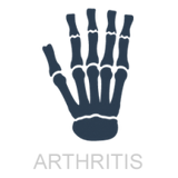 arthritis