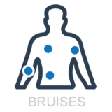 bruises