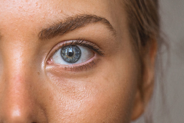 Ayurveda for skincare. A close-up shot of a caucasian woman's face showing one blue eye and a nose. Her skin shows slight bumps and oiliness. 