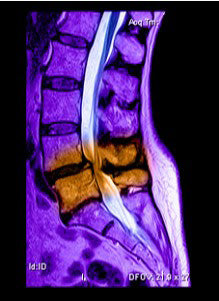 neck pain with cold