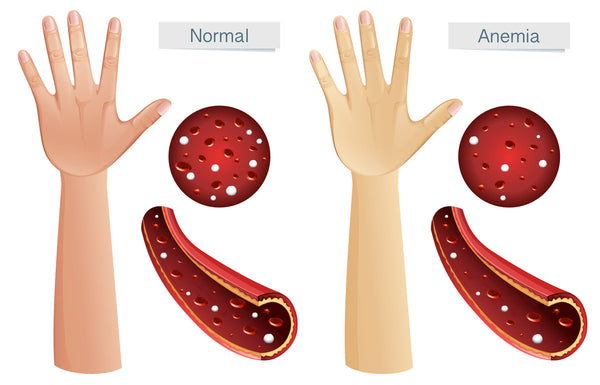 stomach and back pain after eating