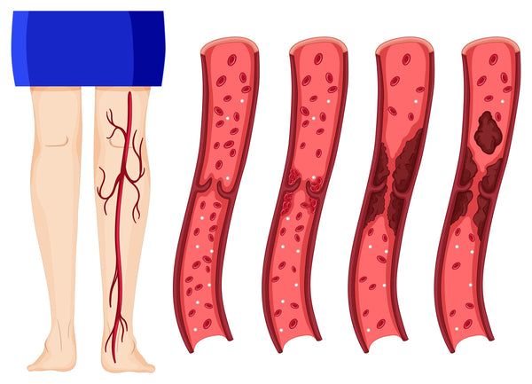 pain behind the knee