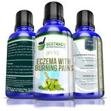 Eczema with burning pains natural remedy