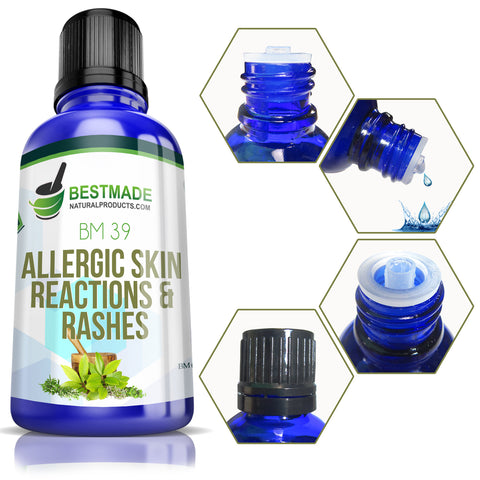 Allergic skin reactions and rashes remedy
