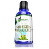 Skin blisters natural remedy