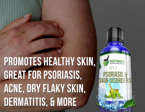 Psoriasis and skin disorders natural remedy