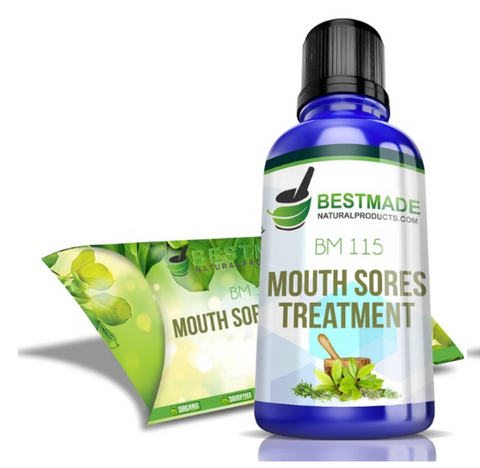 Mouth sores treatment natural remedy