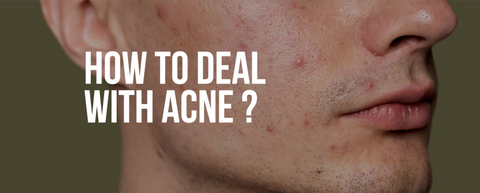 Acne Scarring & Pimples Natural Solution (BM38)