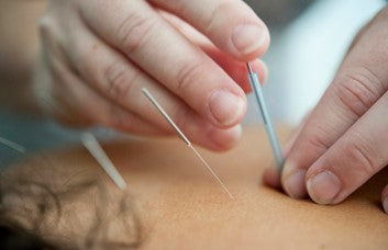 Acupuncture practice.