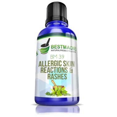 Allergic skin reaction and rashes