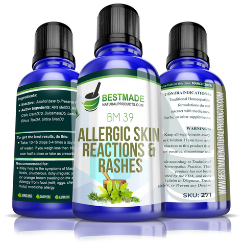 Allergic skin reactions & rashes