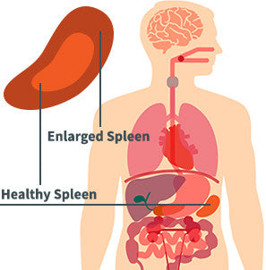 Enlarged Spleen Natural Remedy & Support (BM32)