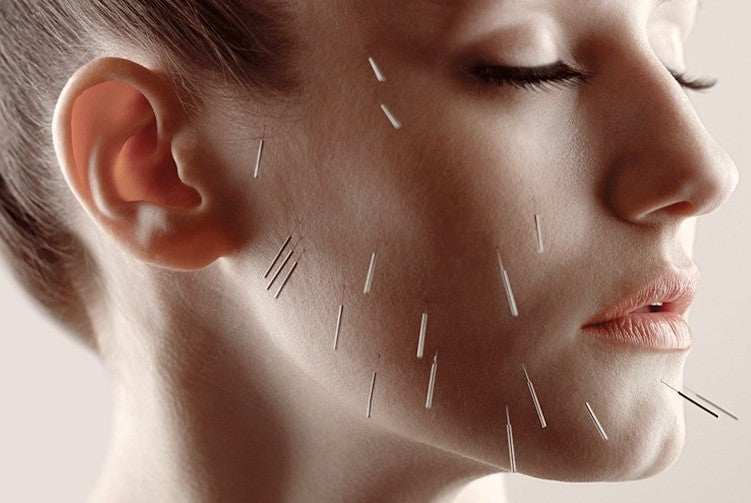 Facial acupuncture