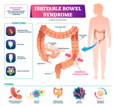 Irritable Bowel Syndrome symptoms and causes