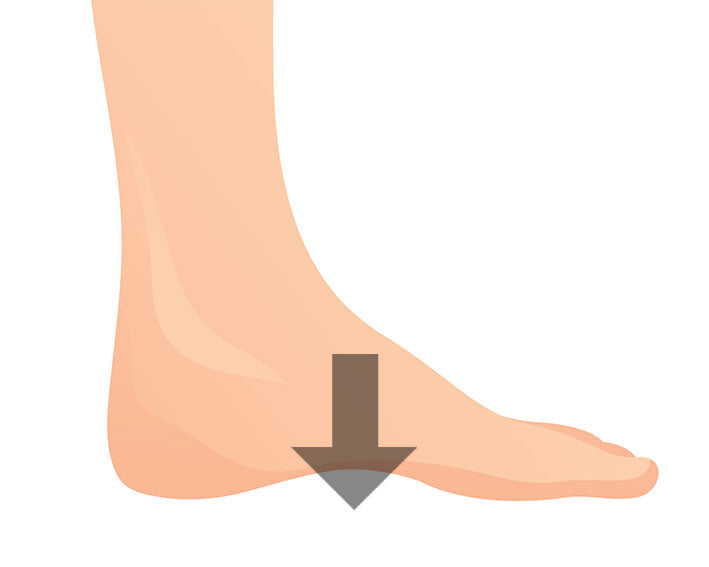 rigid orthotics for overpronation