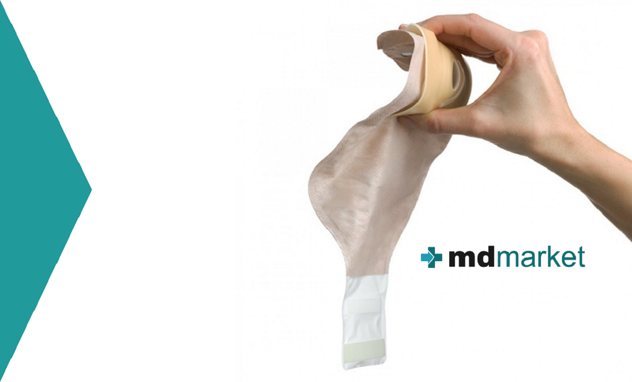 La convexidad en el manejo de las ostomías: Mdmarket