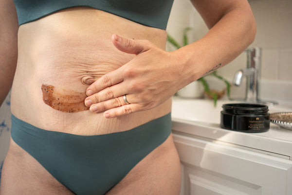 Stretch Marks Scrub Exfoliator 