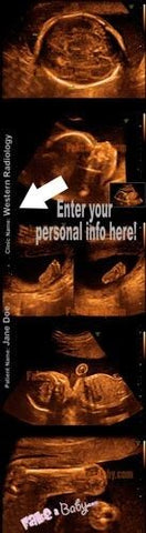 Create 4D Fake Ultrasounds!