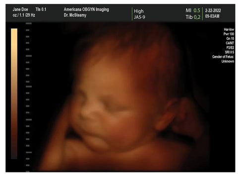 Create a Fake 4D Ultrasound Here!